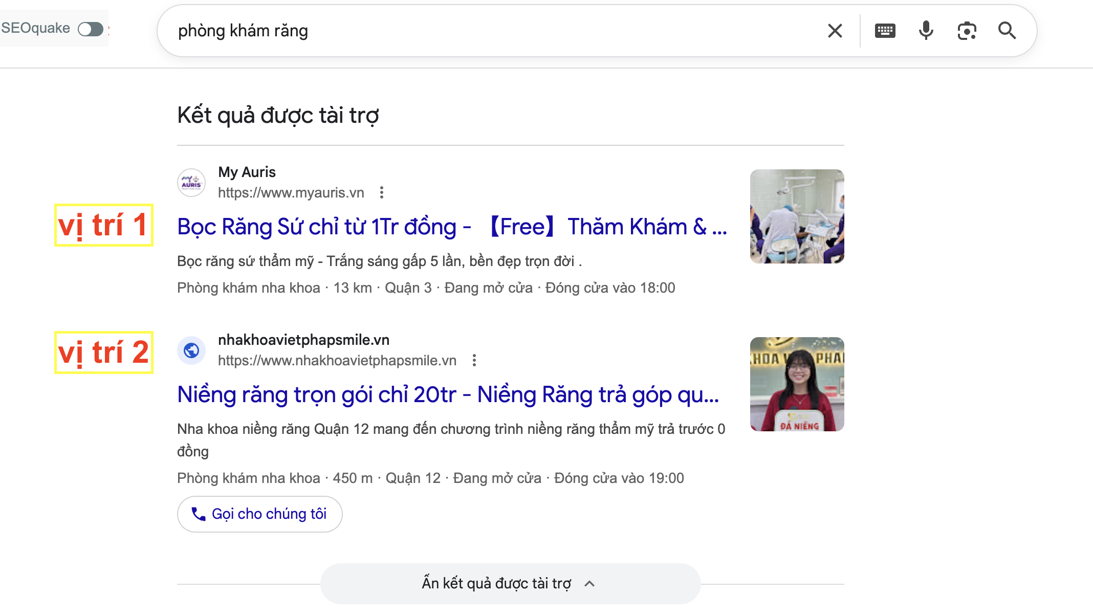 marketting nha khoa tại clickweb